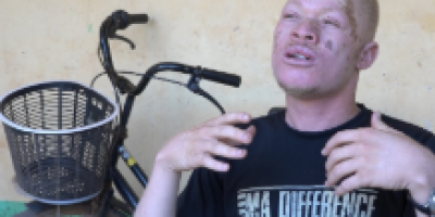 Burkina : Le combat des personnes albinos