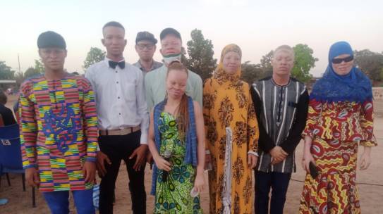Burkina : La semaine artistique de l’association des femmes albinos a été un succès